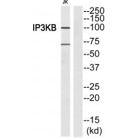 Anti-ITPKB Antibody