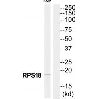 Anti-RPS18 Antibody