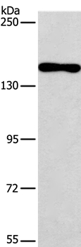 Anti-PDS5B Antibody