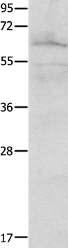 Anti-FOXJ2 Antibody