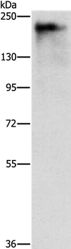 Anti-ATAD5 Antibody