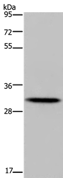 Anti-HOXB8 Antibody