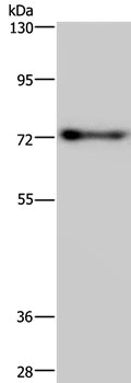 Anti-PATZ1 Antibody