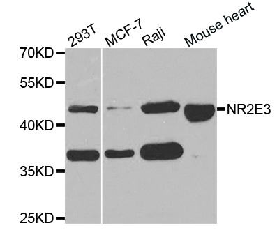 Anti-NR2E3 Antibody