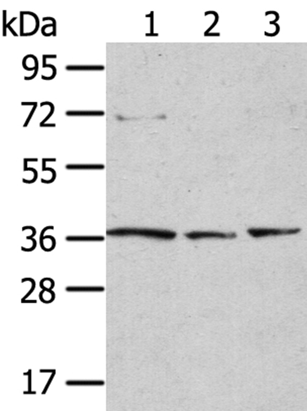 Anti-TPST1 Antibody