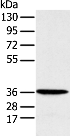 Anti-MAT2B Antibody