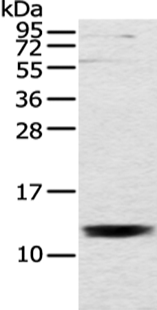Anti-UQCRH Antibody