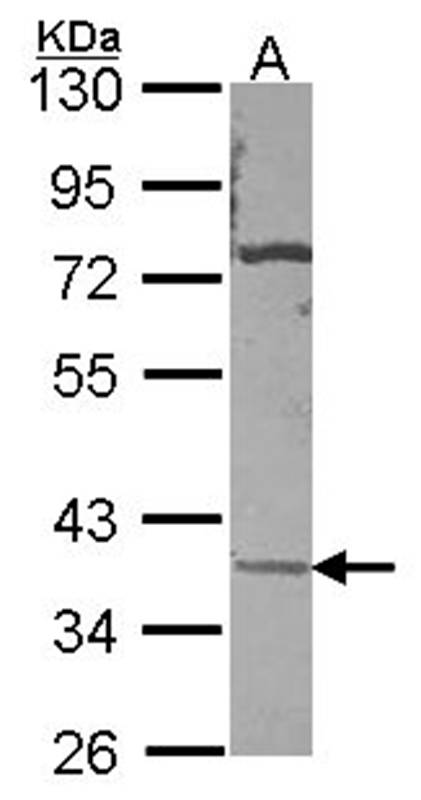 Anti-CA11 Antibody