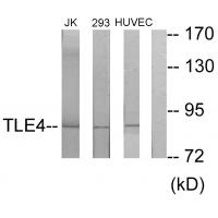 Anti-TLE4 Antibody