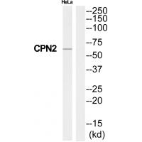 Anti-CPN2 Antibody