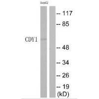 Anti-CDY1 Antibody