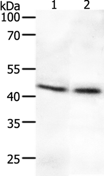Anti-SYT2 Antibody
