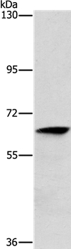Anti-ALG6 Antibody