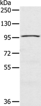 Anti-CIZ1 Antibody