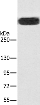 Anti-RYR1 Antibody