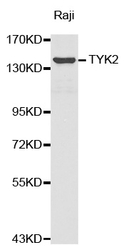 Anti-TYK2 Antibody Anti-TYK2 Antibody
