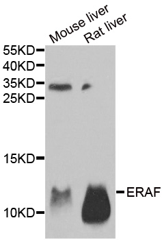 Anti-AHSP Antibody