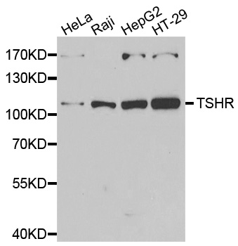 Anti-TSHR Antibody