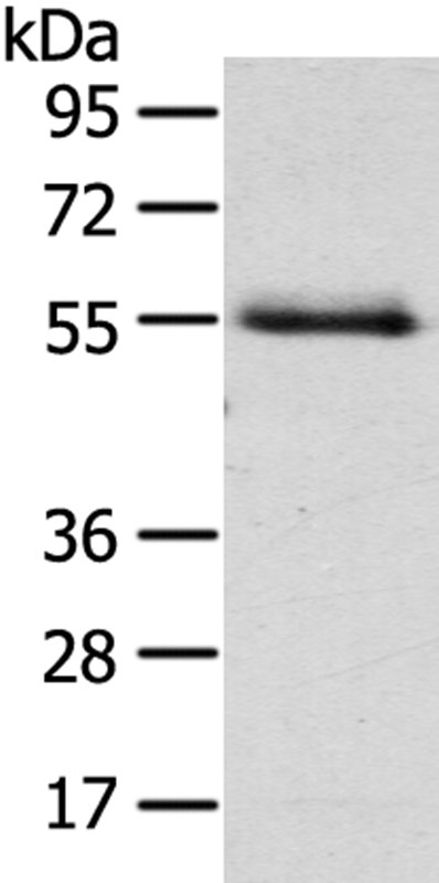 Anti-NUF2 Antibody