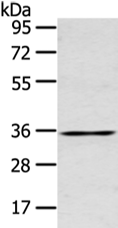 Anti-GJB5 Antibody