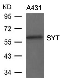 Anti-SYT Antibody