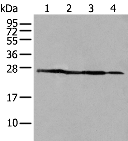 Anti-ARHGDIB Antibody