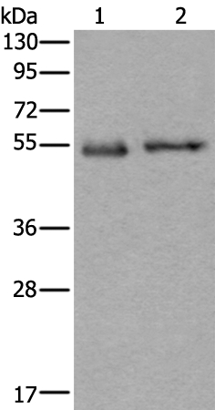 Anti-SLC38A1 Antibody