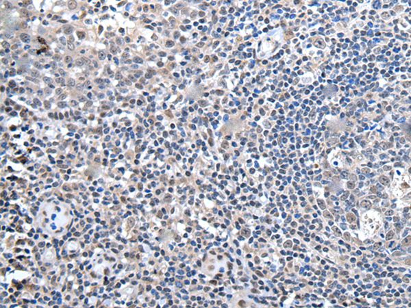 Anti-ZBTB10 Antibody Anti-ZBTB10 Antibody