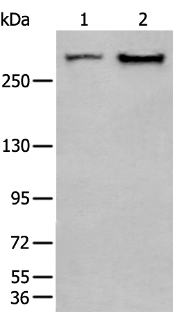 Anti-SPTA1 Antibody