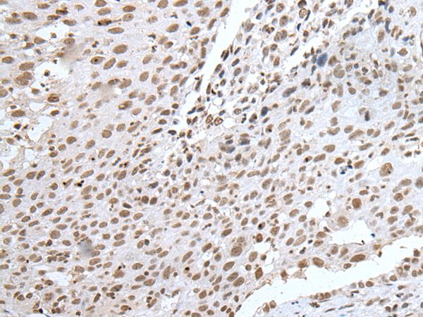 Anti-RBM8A Antibody Anti-RBM8A Antibody