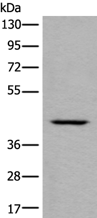 Anti-DSCC1 Antibody