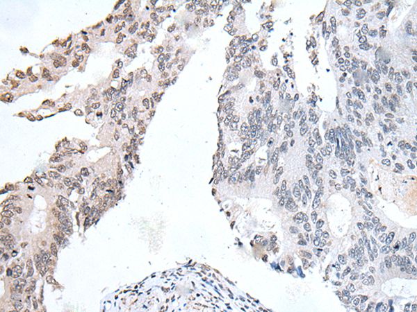 Anti-DSCC1 Antibody Anti-DSCC1 Antibody