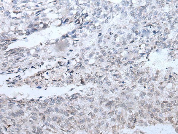 Anti-DSCC1 Antibody Anti-DSCC1 Antibody