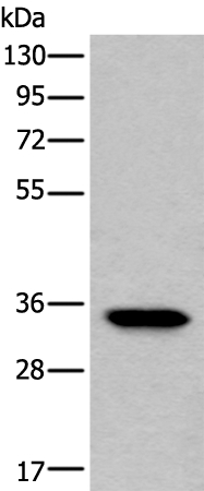 Anti-LDHC Antibody