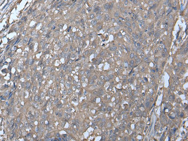 Anti-LDHC Antibody Anti-LDHC Antibody
