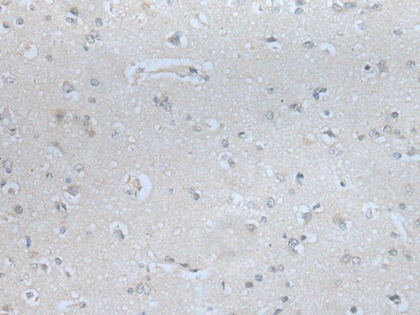 Anti-MBL2 Antibody Anti-MBL2 Antibody