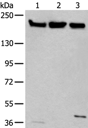 Anti-XRN1 Antibody
