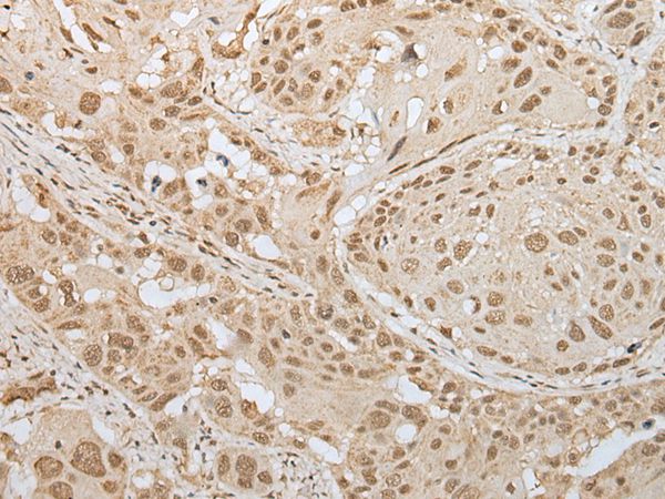 Anti-ZNF8 Antibody Anti-ZNF8 Antibody