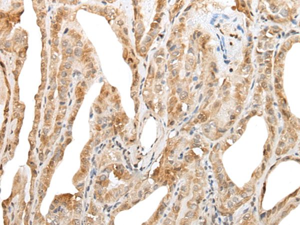 Anti-ZNF8 Antibody Anti-ZNF8 Antibody