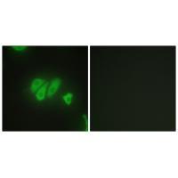 Anti-PDZD2 Antibody Anti-PDZD2 Antibody