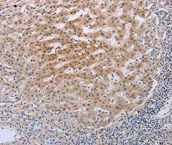 Anti-TNFRSF25 Antibody