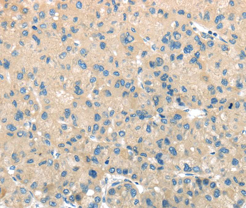 Anti-TMPRSS11A Antibody