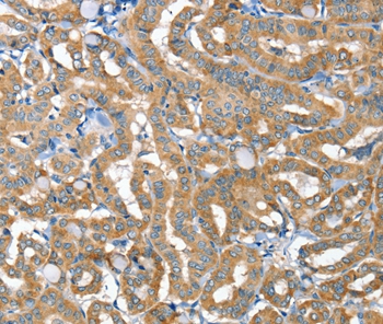 Anti-TNFRSF21 Antibody
