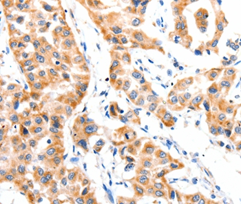 Anti-PAFAH1B1 Antibody