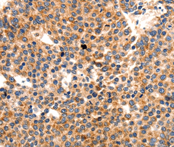 Anti-PAFAH1B1 Antibody Anti-PAFAH1B1 Antibody