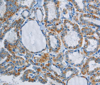 Anti-PPARGC1B Antibody
