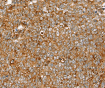 Anti-SIGLEC11 Antibody