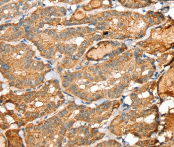 Anti-SIGLEC14 Antibody