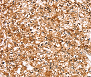 Anti-SLC16A12 Antibody