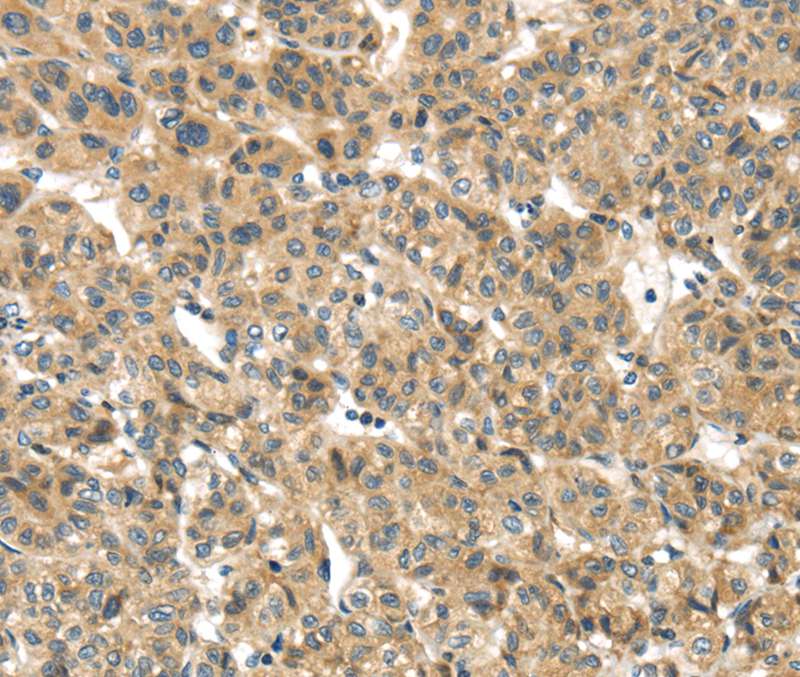 Anti-TMEM161A Antibody